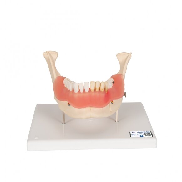 Dantų lygų modelis, 2 kartus padidintas, 21 dalis